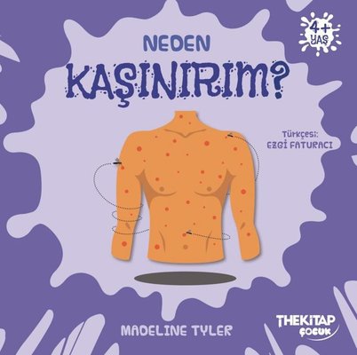 Neden Kaşınırım? Neden Serisi