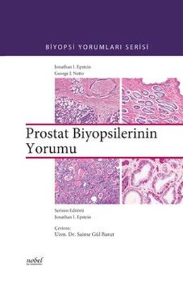 Biyopsilerin Yorumu: Prostat